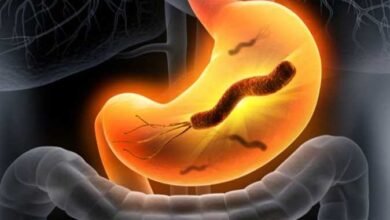 اعراض جرثومة المعدة | جرثومة المعدةمتى تموت | جرثومة المعدة | علاج جرثومة المعدة | علاج جرثومة المعدة نهائيا | أعراض جرثومة المعدة والقولون | أعراض جرثومة المعدة النفسية | هل جرثومة المعدة معدية | تحليل جرثومة المعدة | شكل جرثومة المعدة