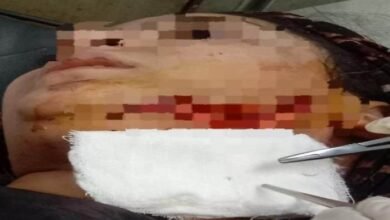 إصابة فتاة قليوب-الأول