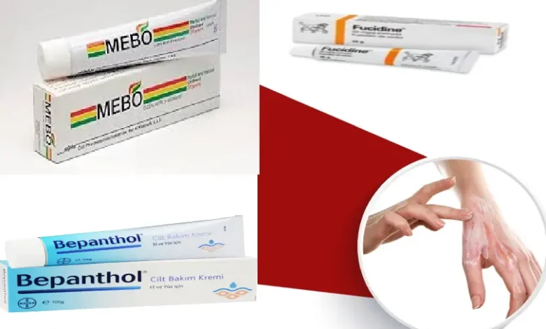 مرهم للحروق