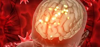 اعراض سرطان المخ